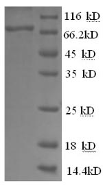 Greater than 90% as determined by SDS-PAGE.Recombinant Human Glucose-6-Phosphate Isomerase (GPI) Protein (His)