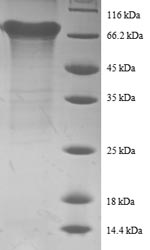 Greater than 90% as determined by SDS-PAGE.Recombinant Human Eukaryotic Initiation Factor 4A-Ii (EIF4A2) Protein (GST)