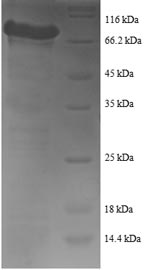 Greater than 90% as determined by SDS-PAGE.Recombinant Human Tyrosine--Trna Ligase, Cytoplasmic Domain (YARS1) Protein (GST)