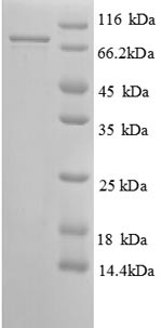 Greater than 90% as determined by SDS-PAGE.Recombinant Human 26S Proteasome Non-Atpase Regulatory Subunit 11 Protein (PSMD11) Protein (GST)