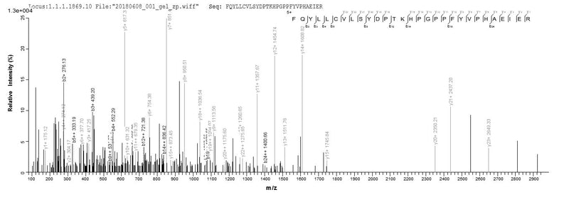 Based on the SEQUEST from database of E.coli host and target protein, the LC-MS/MS Analysis result of this product could indicate that this peptide derived from E.coli-expressed Homo sapiens (Human) TPMT.Recombinant Human Thiopurine S-Methyltransferase (TPMT) Protein (GST)