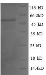 Greater than 90% as determined by SDS-PAGE.Recombinant Human Thiopurine S-Methyltransferase (TPMT) Protein (GST)