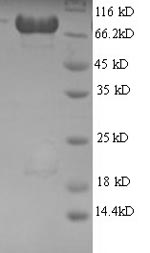 Greater than 90% as determined by SDS-PAGE.Recombinant Human Ap-2 Complex Subunit Mu (AP2M1) Protein (GST)