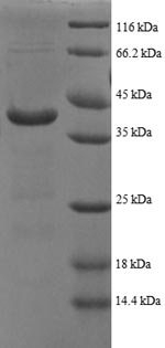 Greater than 90% as determined by SDS-PAGE.Recombinant Human Atp Synthase Subunit Delta, Mitochondrial (ATP5D) Protein (GST)