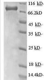 Greater than 90% as determined by SDS-PAGE.Recombinant Human Rab Gdp Dissociation Inhibitor Beta (GDI2) Protein (GST)