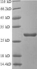 Greater than 90% as determined by SDS-PAGE.Recombinant Human Beta-Adrenergic Receptor Kinase 1 (GRK2) Protein (His)