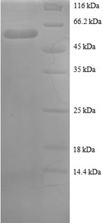 Greater than 90% as determined by SDS-PAGE.Recombinant Human U1 Small Nuclear Ribonucleoprotein A (SNRPA) Protein (GST)