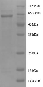 Greater than 90% as determined by SDS-PAGE.Recombinant Human Serine/Threonine-Protein Phosphatase 2A Catalytic Subunit Beta Isoform (PPP2CB) Protein (GST)