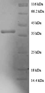 Greater than 90% as determined by SDS-PAGE.Recombinant Human Death-Associated Protein 1 (DAP) Protein (GST)