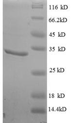Greater than 90% as determined by SDS-PAGE.
