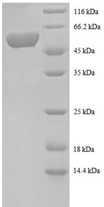 Greater than 90% as determined by SDS-PAGE.Recombinant Human Spermidine Synthase (SRM) Protein (GST)