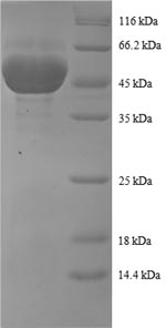 Greater than 90% as determined by SDS-PAGE.Recombinant Human Peroxiredoxin-1 (PRDX1) Protein (GST)