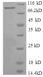 Greater than 90% as determined by SDS-PAGE.Recombinant Human Inosine-5'-Monophosphate Dehydrogenase 2 (IMPDH2) Protein (GST)