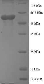 Greater than 90% as determined by SDS-PAGE.Recombinant Human Casein Kinase I Isoform Epsilon (CSNK1E) Protein (GST)