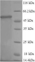 Greater than 90% as determined by SDS-PAGE.Recombinant Human Proteasome Subunit Beta Type-1 (PSMB1) Protein (GST)