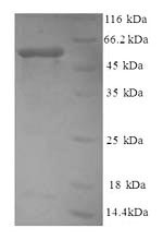 Greater than 90% as determined by SDS-PAGE.Recombinant Human Myosin-9 (MYH9) Protein (GST)