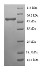 Greater than 90% as determined by SDS-PAGE.Recombinant Human Rho Guanine Nucleotide Exchange Factor 7 (ARHGEF7) Protein (GST)