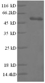 Greater than 90% as determined by SDS-PAGE.Recombinant Human High Mobility Group Protein B1 (HMGB1) Protein (GST)
