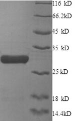 Greater than 90% as determined by SDS-PAGE.Recombinant Human X-Ray Repair Cross-Complementing Protein 6 (XRCC6) Protein (His)