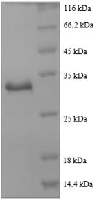 Greater than 90% as determined by SDS-PAGE.Recombinant Human Actin, Cytoplasmic 1 (ACTB) Protein (His)