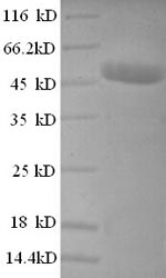 Greater than 90% as determined by SDS-PAGE.Recombinant Human Casein Kinase Ii Subunit Beta (CSNK2B) Protein (GST)