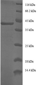 Greater than 90% as determined by SDS-PAGE.Recombinant Human Alpha-Endosulfine (ENSA) Protein (GST)