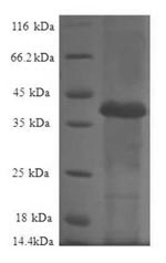 Greater than 90% as determined by SDS-PAGE.