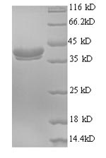 Greater than 90% as determined by SDS-PAGE.Recombinant Human Ubiquitin-Like Protein Fubi (FAU) Protein (GST)