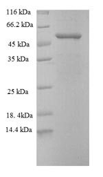 Greater than 90% as determined by SDS-PAGE.Recombinant Human Disintegrin And Metalloproteinase Domain-Containing Protein 15 (ADAM15) Protein (GST)