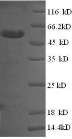 Greater than 90% as determined by SDS-PAGE.Recombinant Human Membrane-Associated Phosphatidylinositol Transfer Protein 1 (PITPNM1) Protein (GST)