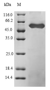 Greater than 90% as determined by SDS-PAGE.Recombinant Human Zinc Finger Protein 91 (ZNF91) Protein (GST)