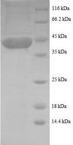 Greater than 90% as determined by SDS-PAGE.Recombinant Human Rhombotin-1 (LMO1) Protein (GST)