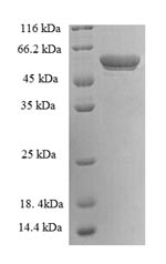 Greater than 90% as determined by SDS-PAGE.Recombinant Human 14-3-3 Protein Eta (YWHAH) Protein (GST)