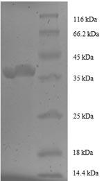 Greater than 90% as determined by SDS-PAGE.Recombinant Human Peptidyl-Prolyl Cis-Trans Isomerase Fkbp1A (FKBP1A) Protein (GST)