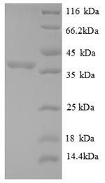 Greater than 90% as determined by SDS-PAGE.Recombinant Human 60S Acidic Ribosomal Protein P2 (RPLP2) Protein (GST)