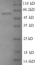 Greater than 90% as determined by SDS-PAGE.Recombinant Human 60S Ribosomal Protein L3 (RPL3) Protein (GST)