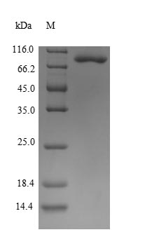 Greater than 90% as determined by SDS-PAGE.Recombinant Human Alpha-Enolase (ENO1) Protein (GST)