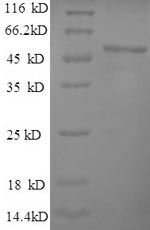 Greater than 90% as determined by SDS-PAGE.Recombinant Human 60S Ribosomal Protein L15 (RPL15) Protein (GST)