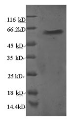 Greater than 90% as determined by SDS-PAGE.Recombinant Human 60S Ribosomal Protein L5 (RPL5) Protein (GST)