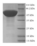 Greater than 90% as determined by SDS-PAGE.Recombinant Human 60S Ribosomal Protein L17 (RPL17) Protein (GST)