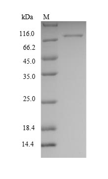 Greater than 90% as determined by SDS-PAGE.Recombinant Human Heterogeneous Nuclear Ribonucleoprotein K (HNRNPK) Protein (GST)