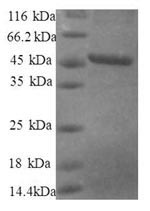 Greater than 90% as determined by SDS-PAGE.Recombinant Human 40S Ribosomal Protein S10 (RPS10) Protein (GST)