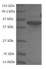 Greater than 90% as determined by SDS-PAGE.Recombinant Human Small Nuclear Ribonucleoprotein Sm D2 (SNRPD2) Protein (GST)