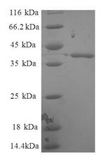 Greater than 90% as determined by SDS-PAGE.Recombinant Human Enhancer Of Rudimentary Homolog (ERH) Protein (GST)