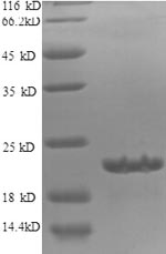 Greater than 90% as determined by SDS-PAGE.Recombinant Human Diamine Acetyltransferase 1 (SAT1) Protein (His)