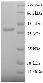 Greater than 90% as determined by SDS-PAGE.Recombinant Human Signal Recognition Particle 14 Kda Protein (SRP14) Protein (GST)