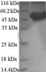 Greater than 90% as determined by SDS-PAGE.Recombinant Human Ribosomal Protein S6 Kinase Beta-2 (RPS6KB2) Protein (GST)