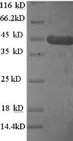 Greater than 90% as determined by SDS-PAGE.Recombinant Human Homer Protein Homolog 1 (HOMER1) Protein (His)