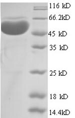 Greater than 90% as determined by SDS-PAGE.Recombinant Human Protein Arginine N-Methyltransferase 1 (PRMT1) Protein (GST)