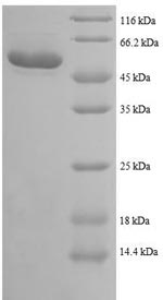 Greater than 90% as determined by SDS-PAGE.Recombinant Human Trifunctional Enzyme Subunit Beta, Mitochondrial (HADHB) Protein (GST)